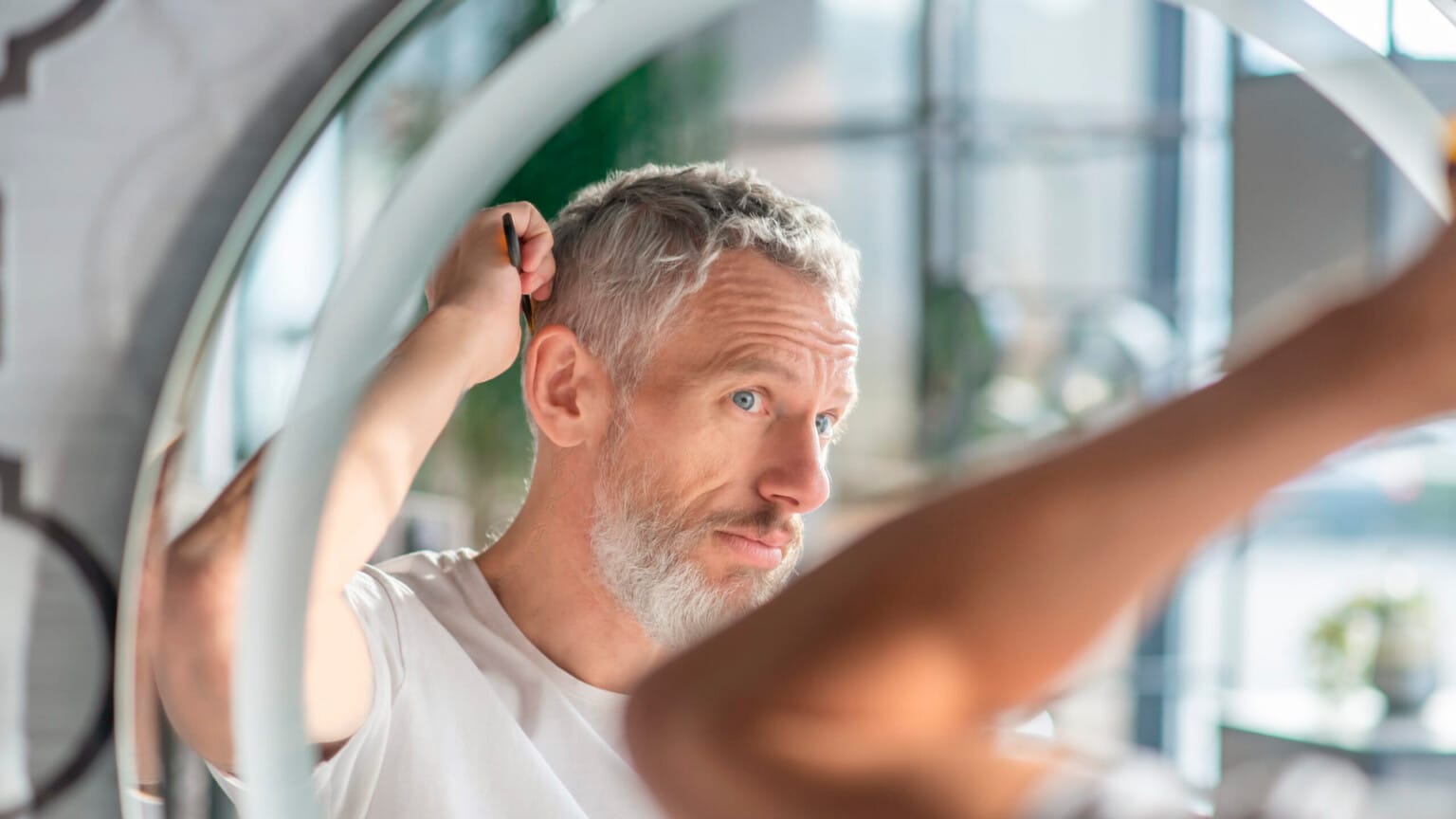 Trasplante capilar en Madrid: todo lo que necesitas saber para recuperar tu cabello y confianza