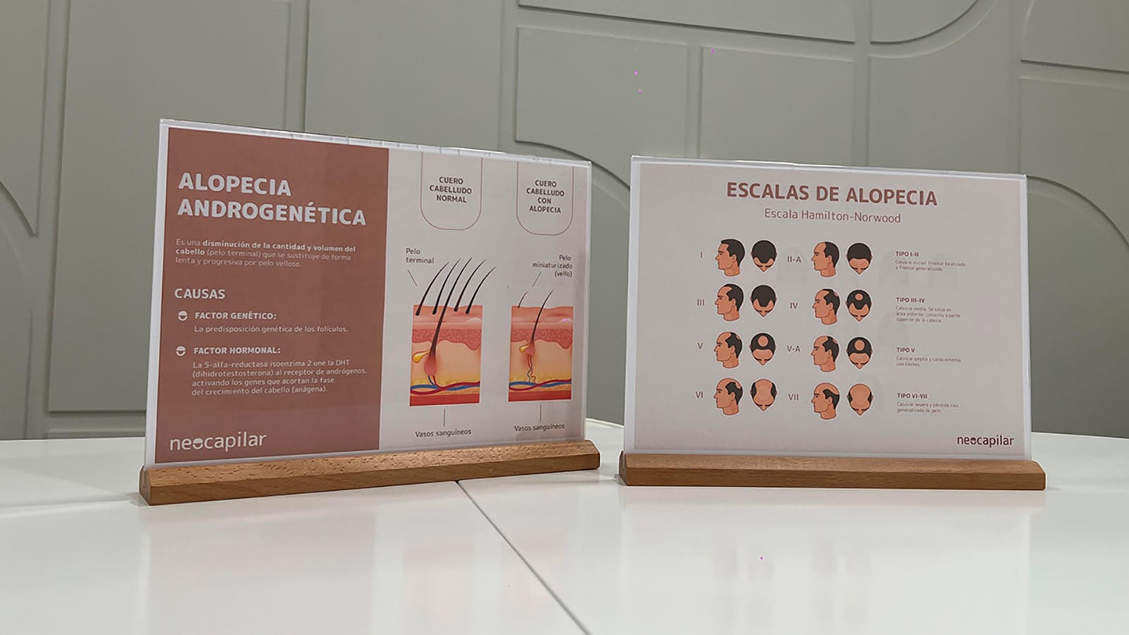 Escala de Hamilton-Norwood: cómo clasificar la alopecia androgenética masculina